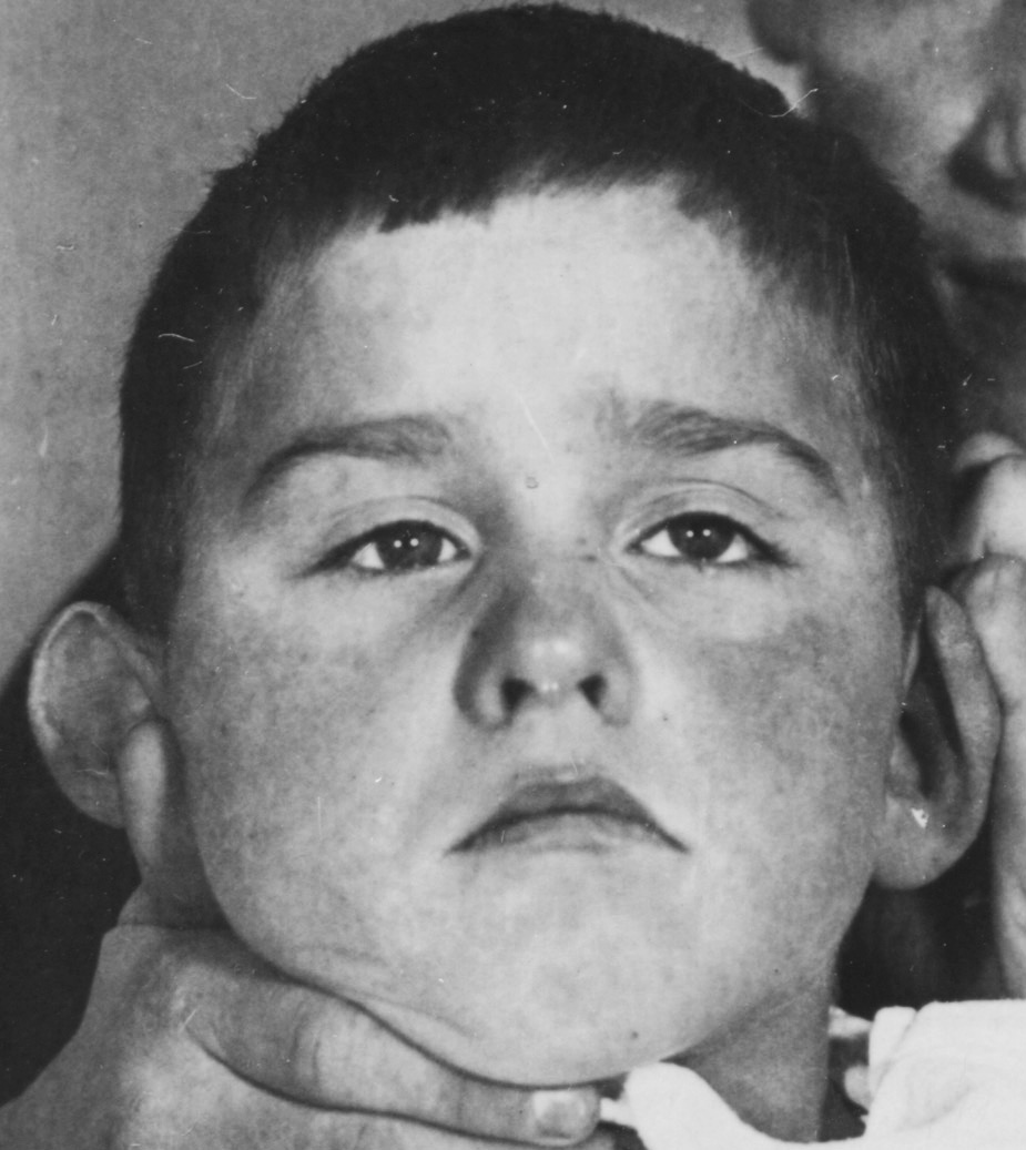 Detlev Davids (für das Foto wurde der Kopf gestützt) Detlev Davids (für das Foto wurde der Kopf gestützt)